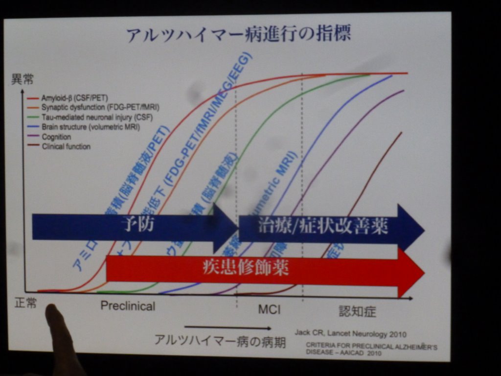 アルツハイマー病進行の指標 写真